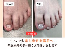 ネイルサロン プロムナード(nailsalon promnade)/深爪に戻らない爪改善