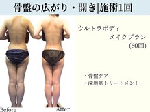 京都フォーエイチ(京都4H)/後ろ姿のエイジングケア♪