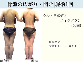 京都フォーエイチ(京都4H)/後ろ姿のエイジングケア♪