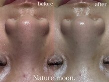ナチュールムーン(Nature moon.)/毛穴洗浄