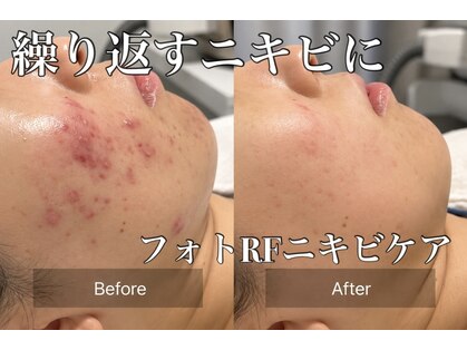 サラ 恵比寿店(SARA)の写真