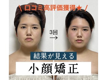 アンジェリオーラ(angeli aura)/整形級小顔