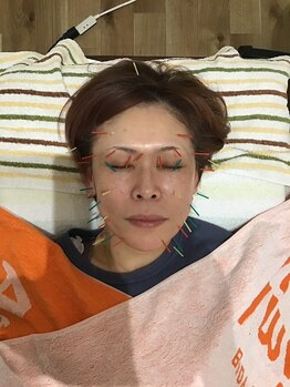 北海道スポーツ整体院/美容鍼灸