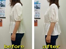 六角橋つつみ接骨院/姿勢の悩みも解消/マッサージ