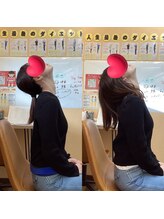 ヒデ整体院(Hide整体院)/首こり肩こり猫背巻き肩骨盤矯正