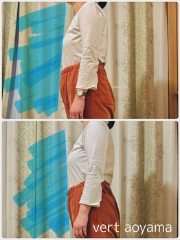 ヴェール 青山(vert)/骨盤矯正ビフォーアフター