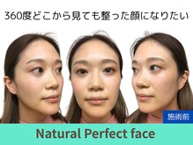 ナチュラルパーフェクトフェイス 新宿