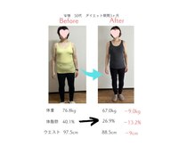 トゥインクル(twinkle)の雰囲気（耳つぼで食欲を自然にコントロール）