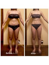 プライベートサロン アール(R)/セルゼロボディ（全身90分）