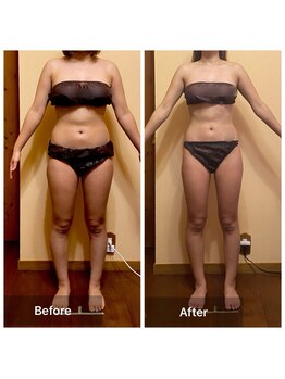 プライベートサロン アール(R)/セルゼロボディ（全身90分）