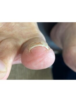 爪の悩みを解消できる（ケア含む）