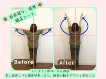 整体院リフィール/Before&After【骨盤/姿勢/整体】
