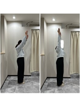 緑地公園鍼灸整骨院/施術後の写真