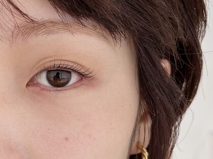 ネストアイ(NEST eye)の写真