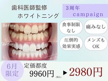 歯のホワイトニング 岐阜アクティブG店
