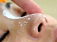 ゼ ロ(ZE RO)/小鼻集中ピーリング