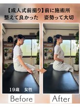 ウェルビーイング整体院 水戸赤塚店(wellbeing整体院)/Before After