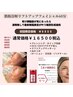 フェイスラインが気になる方へ♪【脂肪分解小顔フェイシャル】¥11000→¥8800