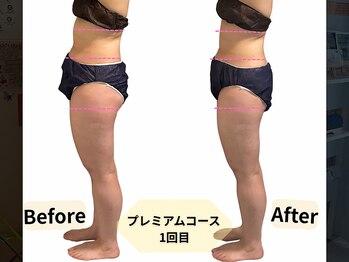 ヨサパーク ナナ リシェス(YOSA PARK nana Richesse)/プレミアムコース1回目