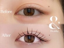 エイチ アイラッシュ 吉祥寺店(H eyelash)/アンドヘルシー