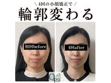 キュープ 奈良天理店(Qpu)