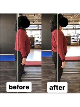 カワル整体 上通り院/反り腰、外腿が張る理由