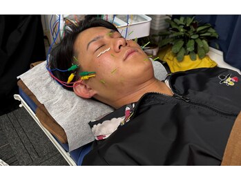 つばさはりきゅう院の写真/清潔感は、つくれる。男の美容鍼、はじめませんか？