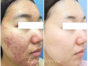 エピア 豊田店(Epia)の写真/皮膚科に通っている方からの相談が増えています