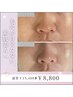 【開き・たるみ・黒ずみ毛穴】ファンデの毛穴落ちを防ぐ陶器肌ケア60分
