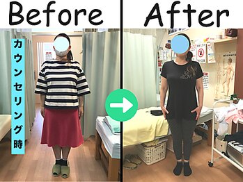 杉本接骨鍼灸院/ 【ダイエット】52歳　6.1キロ