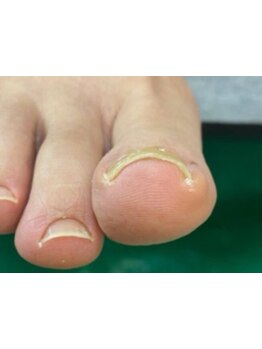 スゴ腕の施術者がいるサロン