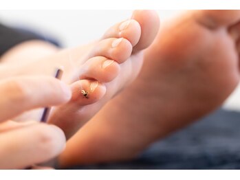 鍼灸ハリゴコチ 一宮/お灸