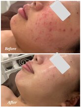 ファシル(Facile)/敏感肌ケア