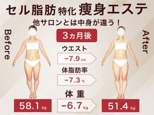 ラ パルレ 松本店の雰囲気（全身ボディケア/サイズダウン/体型ケア/温熱ケア/セル脂肪）