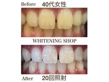 ホワイトニングショップ 池田店の雰囲気（誰でも簡単40分寝るだけ照射。スマホを触りながらも施術OK!）