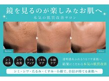 ミルジュ(MiLuJu)