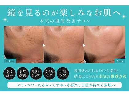 ミルジュ(MiLuJu)の写真