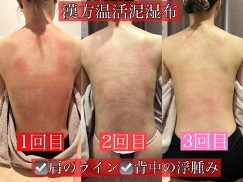 フェアリー 小松店/NEW!漢方温活泥湿布でデトックス