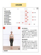 三篠北町整骨院/AIによる姿勢分析