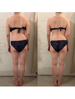 ラナ 京都西院店(Lana)/全身リンパマッサージ