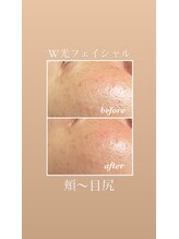 イーストモア(EAST MOIS)/肌リセット！！