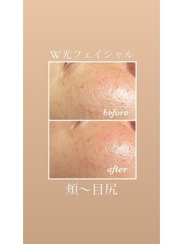 イーストモア(EAST MOIS)/肌リセット！！