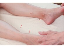 美容鍼灸salonまつもと/