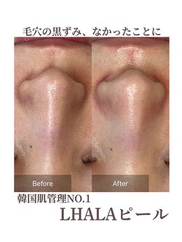 フォルディオ(FORDIO)/ララピール[札幌/円山]