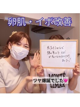 顔凛(カオリン)/お顔のイボも改善