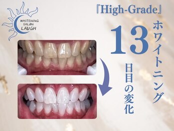 ラフ(LAUGH)/【審・美・白】 ホワイトニング