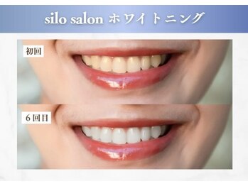 シロサロン(silo salon)