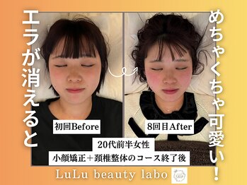 ルルラボ(LuLu beauty labo)/エラが消えると可愛さ倍増!