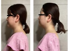 ル・ティアレ/コルギ/ Before・After