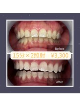ベルプラス 新大阪(Belle plus)/沁みないホワイトニング！